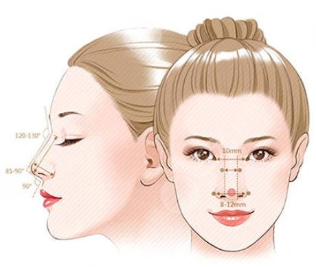 假体隆鼻多少钱