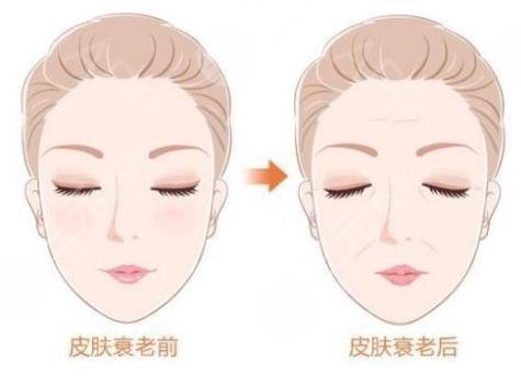 什么是抗衰老