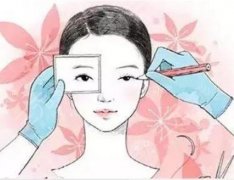 割双眼皮的坏处有哪些？医美不盲目，美眼科普先熟读！