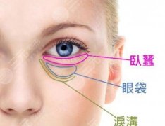 抽脂去眼袋费用多少钱？科普解析，舍不得？果图种草了！