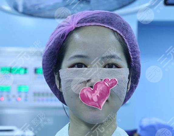 昆明丽都整形医院去眼袋案例