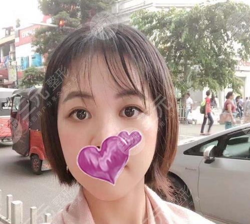 昆明丽都整形医院去眼袋案例