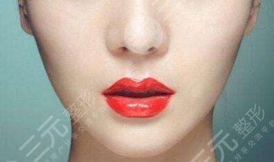 垫下巴的价位大概是多少钱？内附真人垫下巴的果参考~