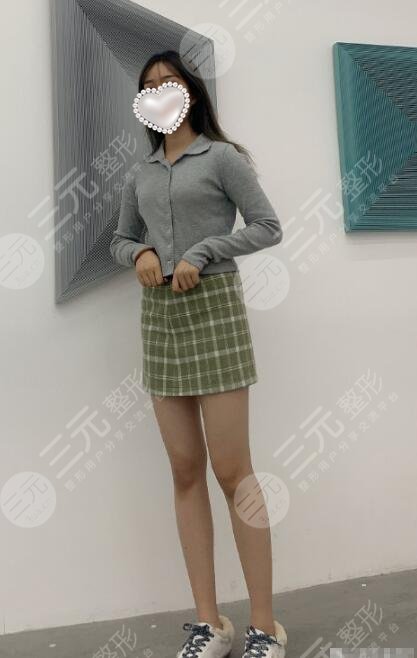 赵军舰医生大腿吸脂