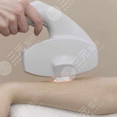 冰点e光收费影响因素