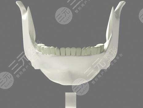 改脸型需要的价格大概是多少