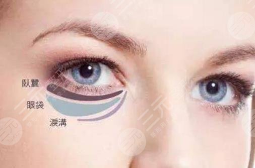 去眼袋方法