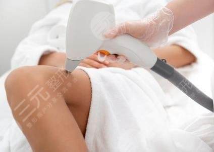 激光脱毛的原理