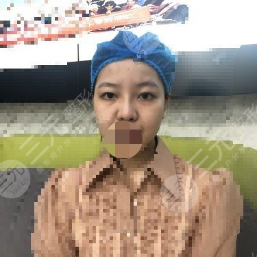 九院热玛吉价格2020