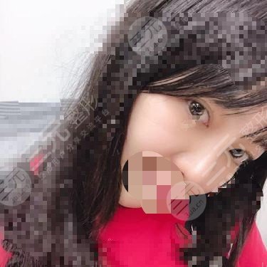 九院热玛吉价格2020