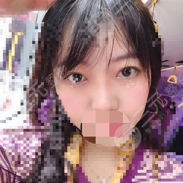 九院热玛吉价格2020