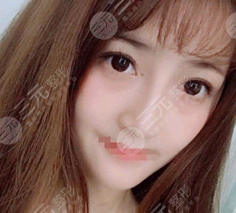 V美减龄后