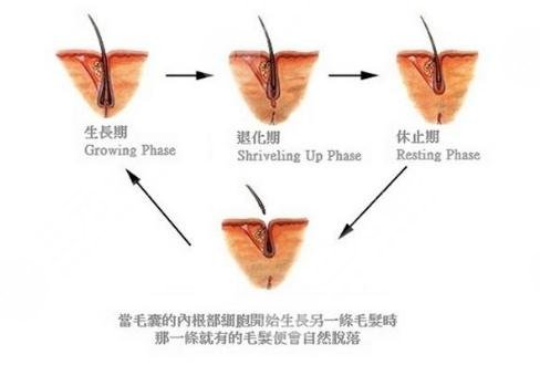 鬓角移植技术原理