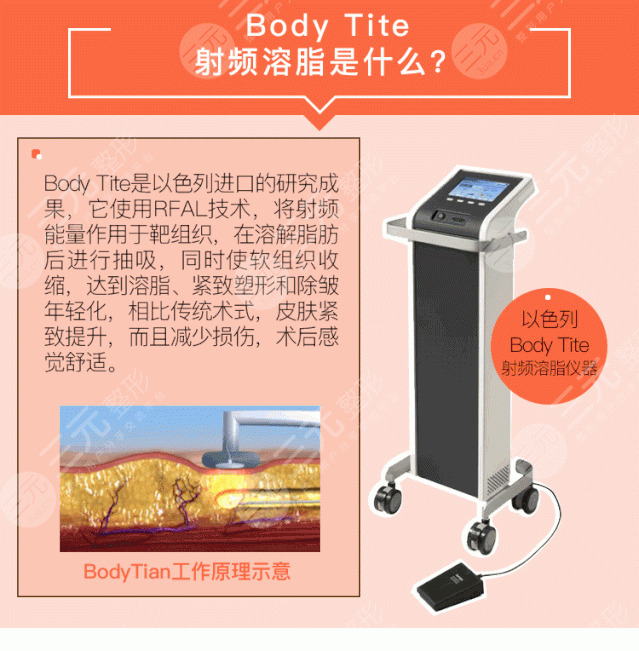 光纤溶脂的优点