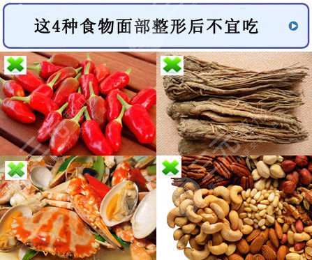 硅胶隆鼻假体取出术后注意事项