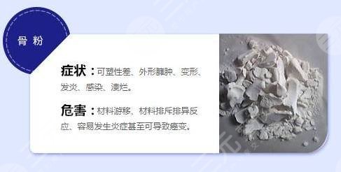 骨粉隆鼻