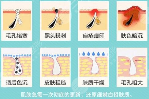 影响黑脸娃娃价格的因素