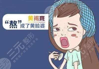 黄褐斑出现的原因