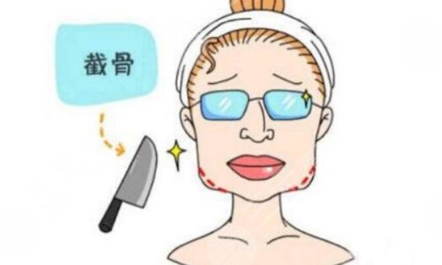 下巴截骨前移果怎么样？下巴截骨前移术前准备和术后护理解析！