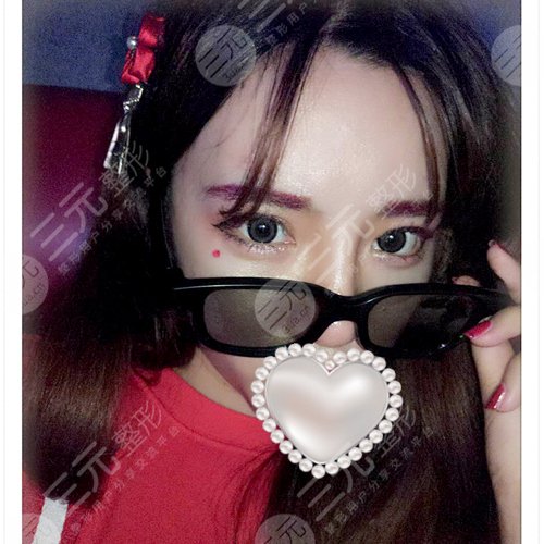 开外眼角3mm图片