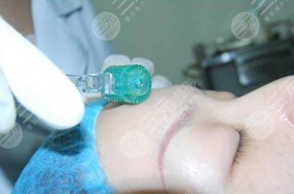 微针美容手术前准备