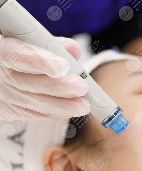 海菲秀多久做一次合适