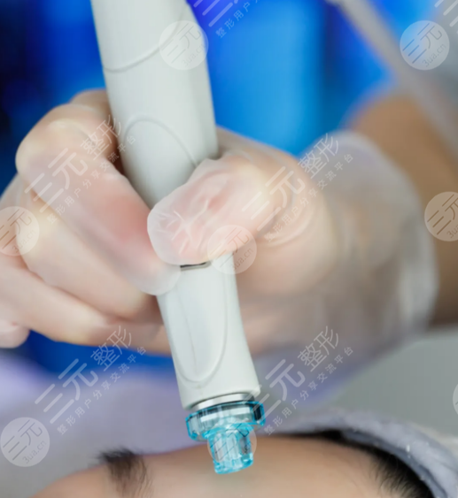 海菲秀多久做一次合适