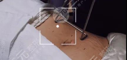 火凤凰溶脂果怎么样