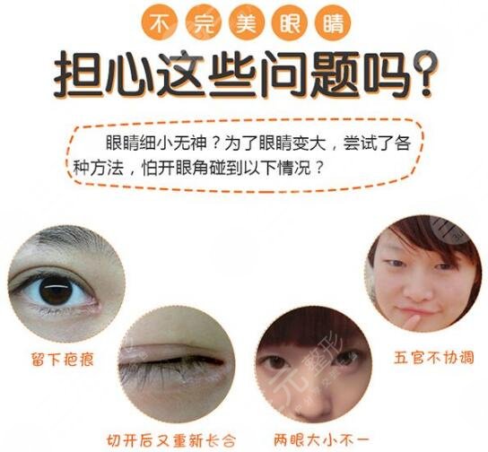 开眼角要注意什么：术前