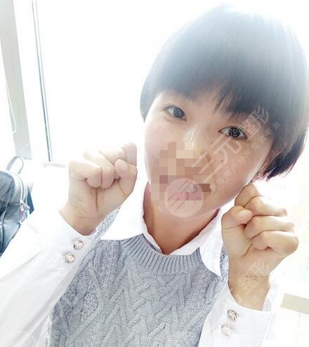 九院激光pm激光祛斑价格