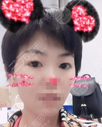 九院激光pm激光祛斑价格