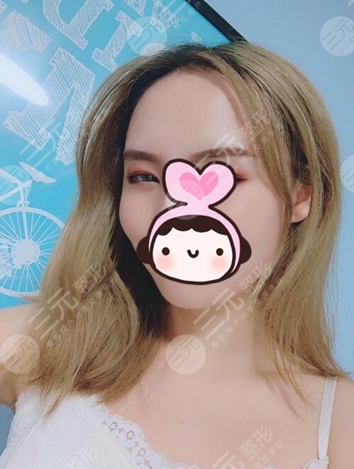 下颌角手术恢复全过程记录