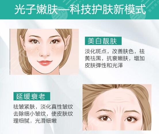 光子嫩肤价格