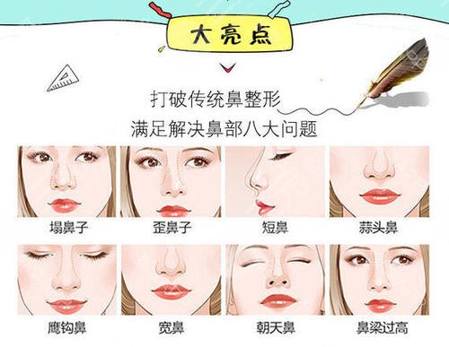 注射隆鼻术一般多少钱?