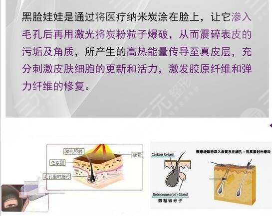 黑脸娃娃的功有哪些