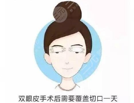 做三点定位双眼皮的注意事项