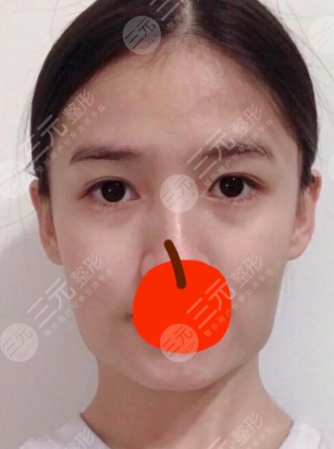 黄金微雕前