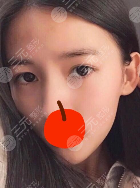 黄金微雕后