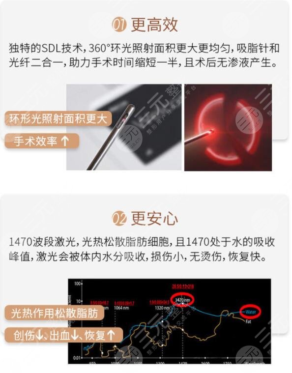 优势