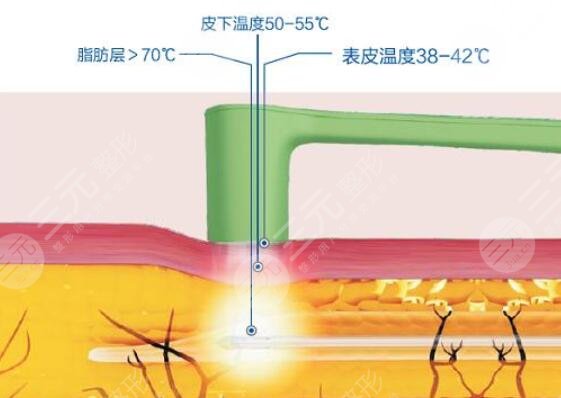 黄金微雕可以保持多久
