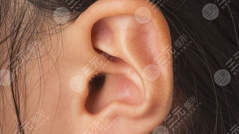 耳再造手术大概多少费用