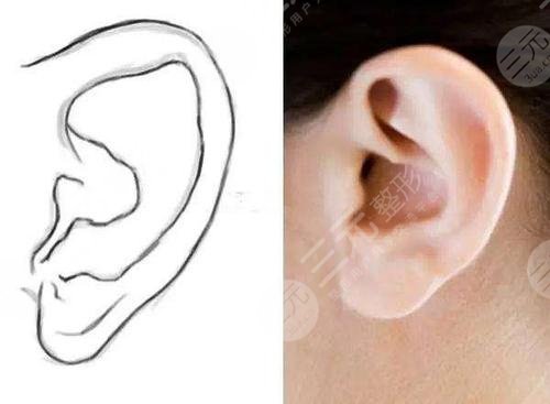 颅耳角在30°-60°之间玻尿酸