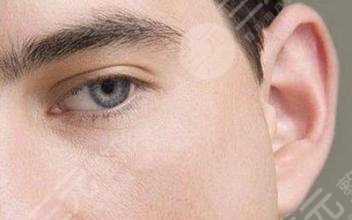 颅耳角在30°-60°之间玻尿酸