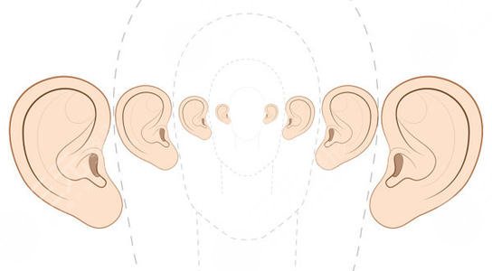 耳再造直埋法耳后疤痕