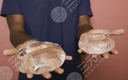 奥美定取出后可以马上做假体吗