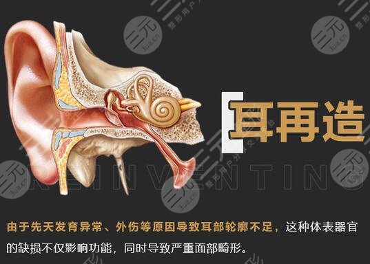 耳再造直埋法耳后疤痕明X吗？来看下科普，如何避免留疤！