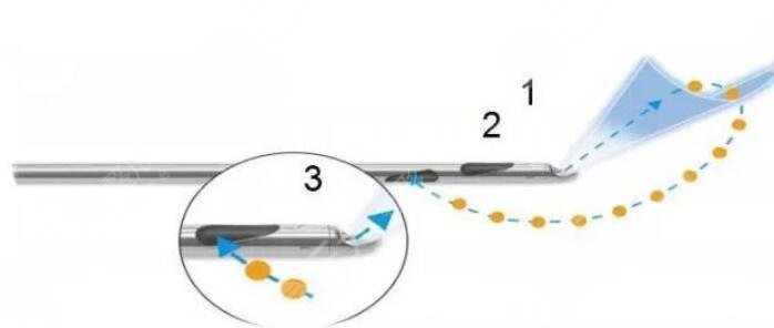 水动力吸脂原理