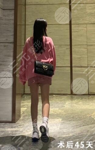 水动力吸脂手术后果