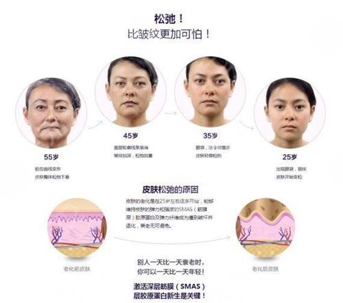 热玛吉果后遗症