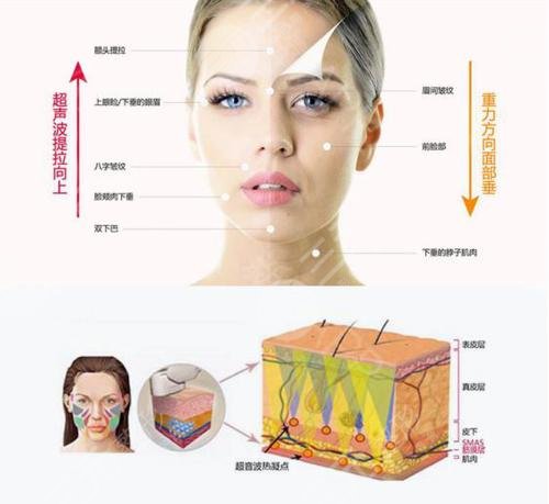 热玛吉的价格多少